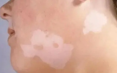 phpfLe8oM